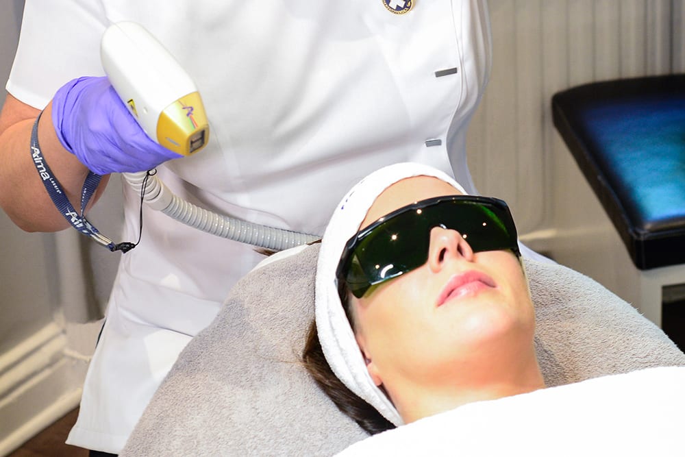 kvinna med svarta skyddsglasögon får behandling med soprano ice platinum hårborttagning