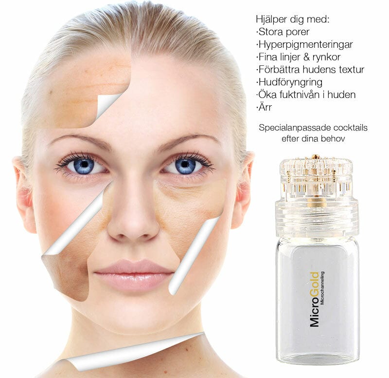 MicroGold-i texten